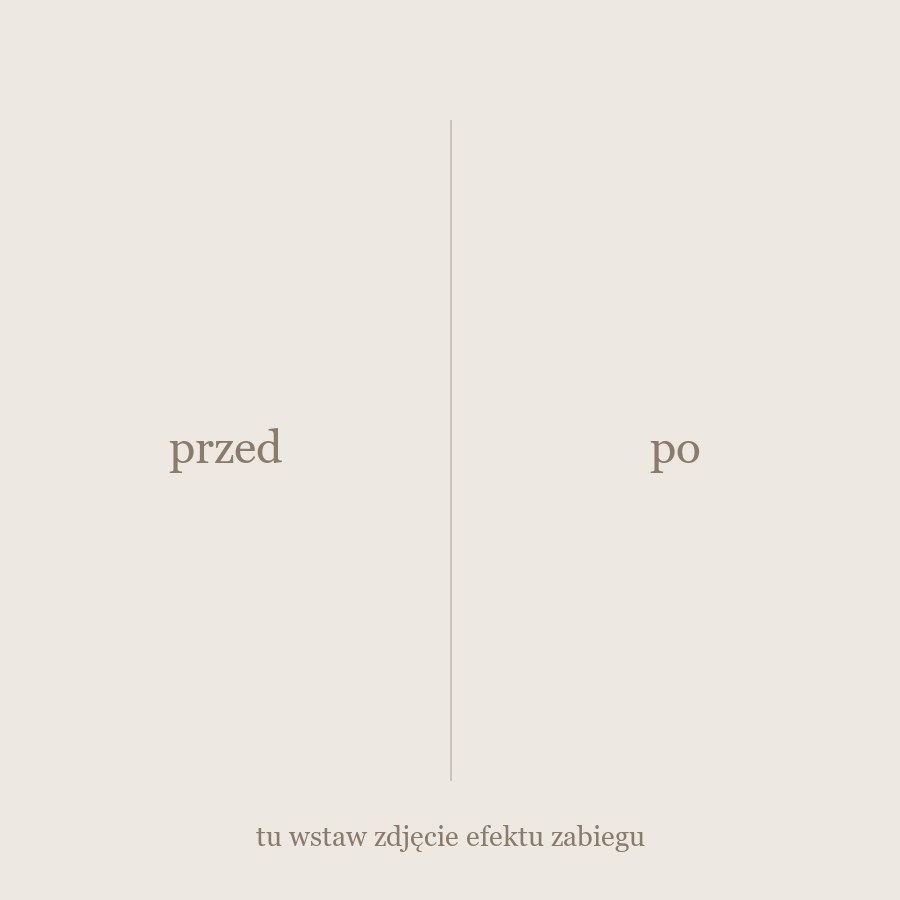 Efekt zabiegu - zdjęcie przed i po
